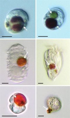 Mesodinium: un piccolo predatore con un gran appetito e una capacità di sopravvivenza incredibile!