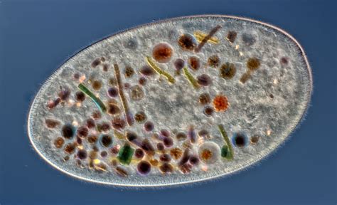 Frontonia: Un piccolo gigante del mondo microscopico! Conosci questo incredibile protozoo ciliato che danza con eleganza tra le gocce d'acqua dolce?